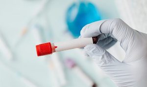sepsis-vucudun-sessiz-firtinasi-dLXrFtAw.jpg