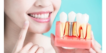 dis-implantlari-hakkinda-bilmeniz-gereken-9-bilgi.jpg