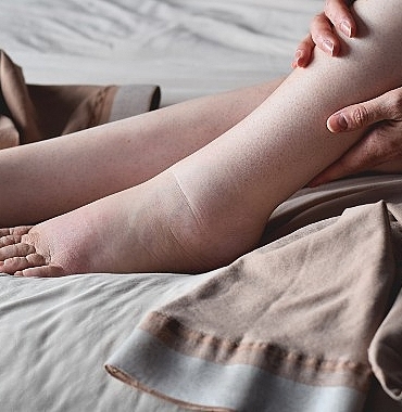 lipodemli-bireylerde-anti-inflamatuar-diyet-yasam-kalitesini-artiriyor.jpg
