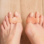 Halluks Rigidus Yorum (1)