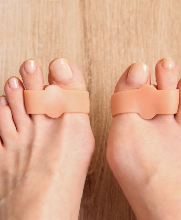 Halluks Rigidus Yorum (1)